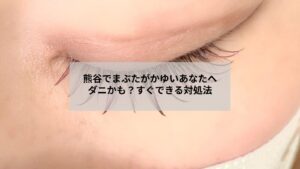 熊谷周辺でまぶたのかゆみやダニの疑いを持つ女性が目元ケアするイメージ画像